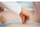 Best Fertility Acupuncture NYC