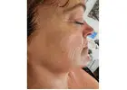 Vale Laser Aesthetics – Leading Skin Specialist Clinic in Cardiff