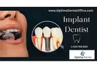 Trusted Implant Dentist in Bristol Delivering Confident Smiles with Precision