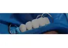 Dental implants Tijuana offers natural-looking and durable teeth replacements