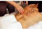Cupping Therapy Toronto: Relieves Tension And Restores Natural Energy Flow