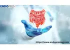 How a Genetic Test for Colon Cancer Helps in Early Detection?