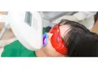 Brighten Your Smile with Trusted Teeth Whitening Dentist Singapore