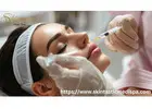 Achieve Natural Enhancement with Lip Fillers Riverside