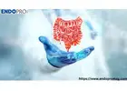 How Genetic Test for Colon Cancer Helps Reduce Risk and Save Lives