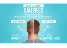 Restore Your Hair and Confidence with New Touch Hair Transplant Clinic Ahmedabad