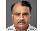 Men’s Hair Wig Shop in Delhi – Raj Hair Wig