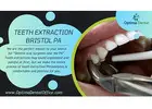 Expert Tooth Extraction Services in Bristol Ensuring Comfortable and Safe Care