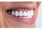 Teeth Whitening In Gurgaon