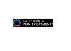 Vein Treatment California