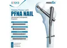 Reliable Fixation with PFNA Nail – Advanced Orthopedic Solution by Siora Surgicals Pvt. Ltd.