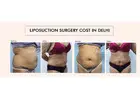 Liposuction Surgery Cost in Delhi: What’s Included and What’s Not