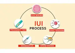 IUI Treatment Cost in Delhi - Dr Rhythm Gupta