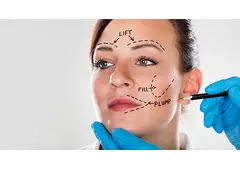 Why I Finally Decided to Get a Facelift and What Surprised Me?