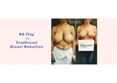 Signs You May Need Breast Reduction Surgery