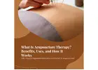 What Is Acupuncture Therapy? Benefits, Uses, and How It Works