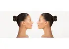 Rhinoplasty Surgery 101: What You Need to Know About Nose Reshaping