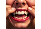No. 1 Guide to Foods That Harm Your Teeth and How to Avoid Them