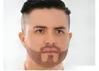 Beard Hair Transplant