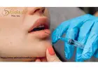 Transform Your Look with Lip Fillers in Riverside