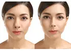 Achieve Your Perfect Nose with the Best Alarplasty Surgeon in Delhi