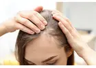 Find Expert Care at Noida’s Leading Hair Loss Treatment Clinic
