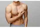 Gynecomastia in Islamabad