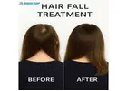Effective Hair Loss Treatment in Noida with Herbal Care
