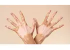 Medical Solutions for Vitiligo Treatment in Islamabad