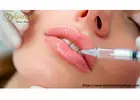Lip Fillers Riverside for Beautiful Volume Boost
