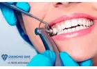 Reliable Dentist in Diamond Bar | Implants & Cleaning Services