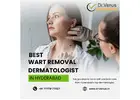 Best Wart Removal Dermatologist In Hyderabad | Dr. Venus
