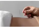 Pain Management Acupuncture in NYC | Back, Neck & Sciatica Relief