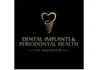 Dental Implants & Periodontal Health