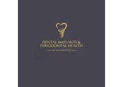 Dental Implants & Periodontal Health
