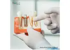 Top Trusted Dental Implant manufacturers in Venezuela for Clinics