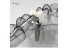 Premium Dental Implant Kits in Nicaragua | Complete Sets