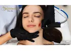 Experience the Ultimate Hydrafacial in Riverside for Glowing Skin