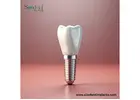 Leading The Best Dental Implants Brands in Guatemala