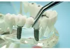 Browse Siiodent Implants Product Catalogue for New Arrivals