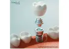 Dental Implant Suppliers for Mexico Distributors Prepared
