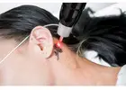 Refresh Your Look at Leading Aesthetic Laser Centre Envy Aesthetics