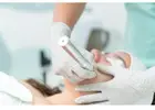 Laser Facial Treatment Altamonte Springs